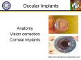 Occular Implants PowerPoint PPT Presentation