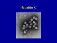 Hepatitis C PowerPoint PPT Presentation