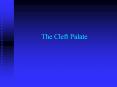 The Cleft Palate PowerPoint PPT Presentation