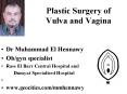 Plastic Surgery of Vulva and Vagina PowerPoint PPT Presentation