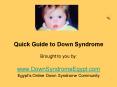 Quick Guide to Down Syndrome PowerPoint PPT Presentation