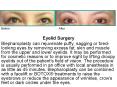 Eyelid Surgery PowerPoint PPT Presentation