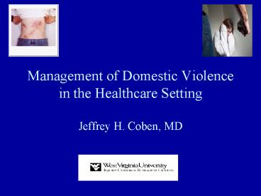Management of Domestic Violence in the Healthcare Setting Jeffrey H. Coben, MD