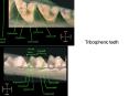 Tribosphenic teeth PowerPoint PPT Presentation