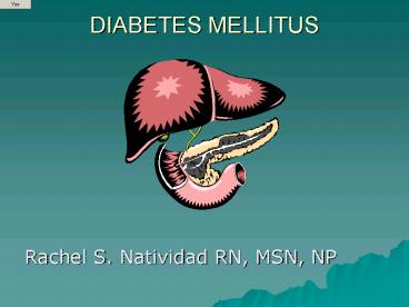 DIABETES MELLITUS