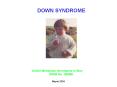 DOWN SYNDROME PowerPoint PPT Presentation