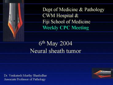 6th May 2004 Neural sheath tumor