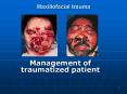 Maxillofacial trauma PowerPoint PPT Presentation