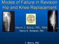 Modes of Failure in Revision Hip and Knee Replacement PowerPoint PPT Presentation
