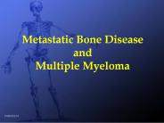Metastatic Bone Disease and Multiple Myeloma