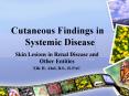 Cutaneous Findings in Systemic Disease PowerPoint PPT Presentation