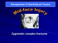 Zygomatic complex fractures PowerPoint PPT Presentation
