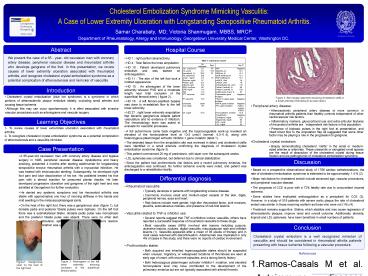 Cholesterol Embolization Syndrome Mimicking Vasculitis: