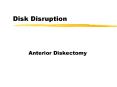 Disk Disruption PowerPoint PPT Presentation
