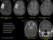 Q9'1' Diagnosis Please
