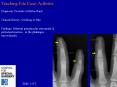 Teaching File Case: Arthritis PowerPoint PPT Presentation