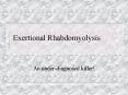 Exertional Rhabdomyolysis PowerPoint PPT Presentation