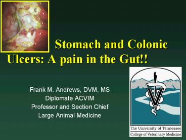 Stomach and Colonic Ulcers: A pain in the Gut