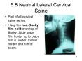 5'8 Neutral Lateral Cervical Spine PowerPoint PPT Presentation