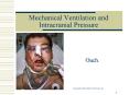 Mechanical Ventilation and Intracranial Pressure PowerPoint PPT Presentation