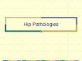 Hip Pathologies PowerPoint PPT Presentation