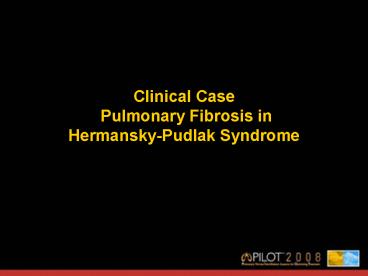 Clinical Case Pulmonary Fibrosis in HermanskyPudlak Syndrome