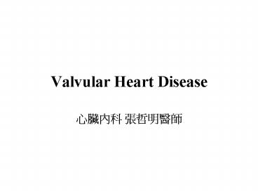 Valvular Heart Disease