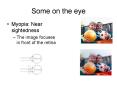 Some on the eye PowerPoint PPT Presentation