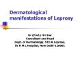 Dermatological manifestations of Leprosy PowerPoint PPT Presentation