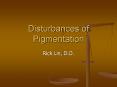Disturbances of Pigmentation PowerPoint PPT Presentation