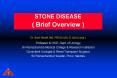 STONE DISEASE PowerPoint PPT Presentation
