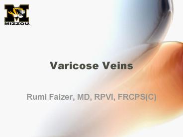 Varicose Veins