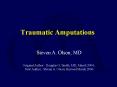 Traumatic Amputations PowerPoint PPT Presentation