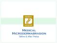 Medical Microdermabrasion PowerPoint PPT Presentation