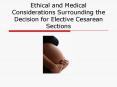 Ethical and Medical Considerations Surrounding the Decision for Elective Cesarean Sections PowerPoint PPT Presentation