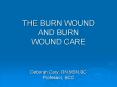 THE BURN WOUND AND BURN WOUND CARE PowerPoint PPT Presentation