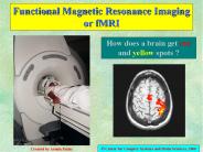 Functional Magnetic Resonance Imaging or fMRI