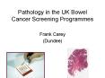 Pathology in the UK Bowel Cancer Screening Programmes PowerPoint PPT Presentation