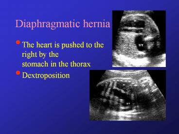 presentation player overlay