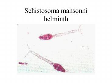 Schistosoma mansonni helminth