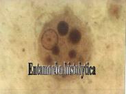 Entamoeba histolytica
