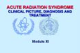ACUTE RADIATION SYNDROME CLINICAL PICTURE, DIAGNOSIS AND TREATMENT PowerPoint PPT Presentation
