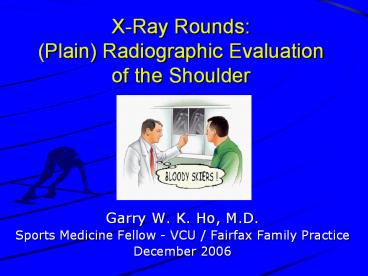 X-Ray Rounds: (Plain) Radiographic Evaluation of the Shoulder