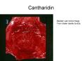 Cantharidin PowerPoint PPT Presentation