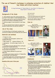 Ppt Treatment For Clubfoot Powerpoint Presentation Free To Download Id 8c07dd Nwq5z Ppt Treatment For Clubfoot Powerpoint Presentation Free To Download Id 8c07dd Nwq5z