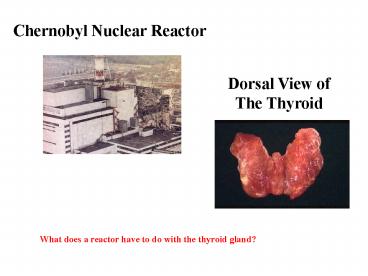 Dorsal View of The Thyroid