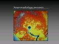 Neuroradiology%20presents PowerPoint PPT Presentation