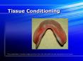Tissue Conditioning PowerPoint PPT Presentation