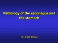 Pathology of the esophagus and the stomach PowerPoint PPT Presentation