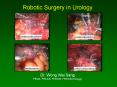 Robotic Surgery in Urology Dr' Wong Wai Sang FRCS, FRACS, FHKAM, FRACSUrology PowerPoint PPT Presentation